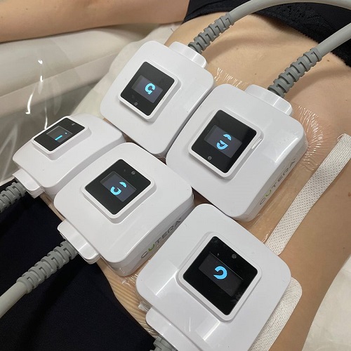 Cutera Trusculpt Body Contouring - Image 2