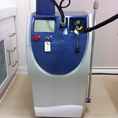 Candela Mini GentleLase Laser
