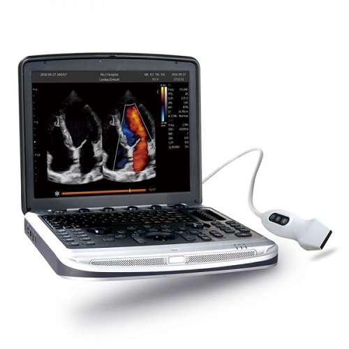 Chison SonoBook 9 Portable Ultrasound