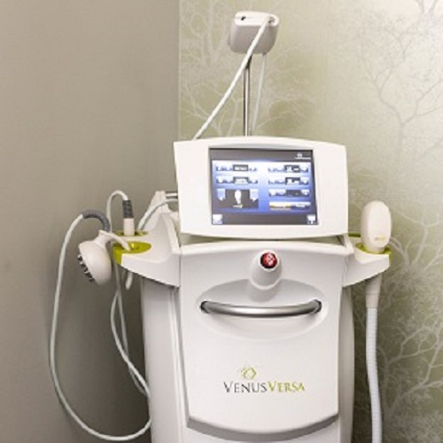 Venus Versa Laser Hair Removal