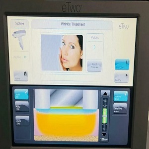 Syneron Candela eTwo Machine