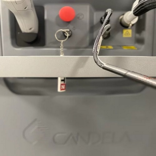 2019 Candela GentleMax Pro + Zimmer - Image 3