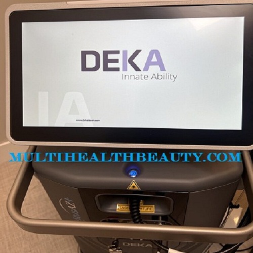 Deka MOTUS AZ+ Laser 1