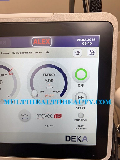 Deka MOTUS AZ+ Laser 2