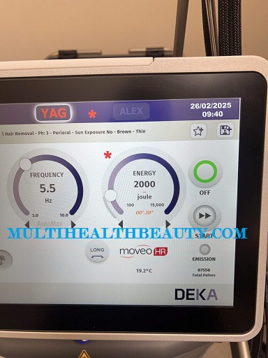 Deka MOTUS AZ+ Laser 3