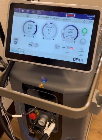 Deka MOTUS AZ+ Laser - MULTIHEALTH BEAUTY