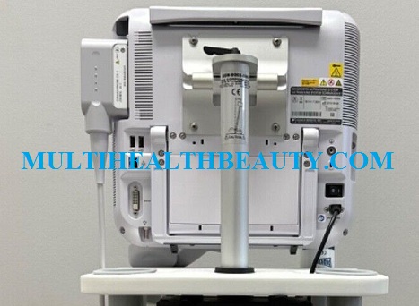 Konica Sonimage MX1 Ultrasound 1
