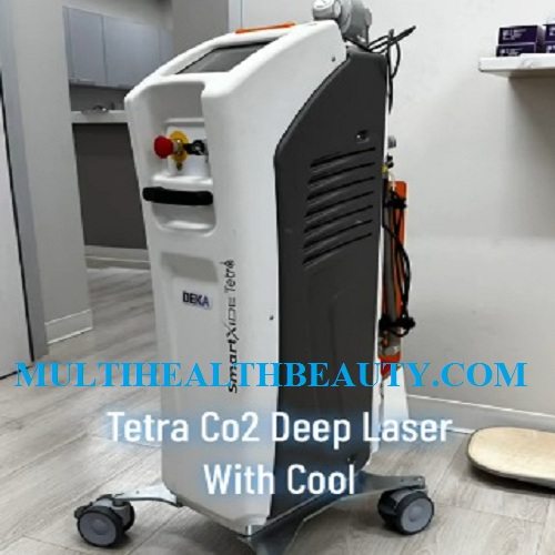 2022 Deka Cartessa Smartxide Tetra